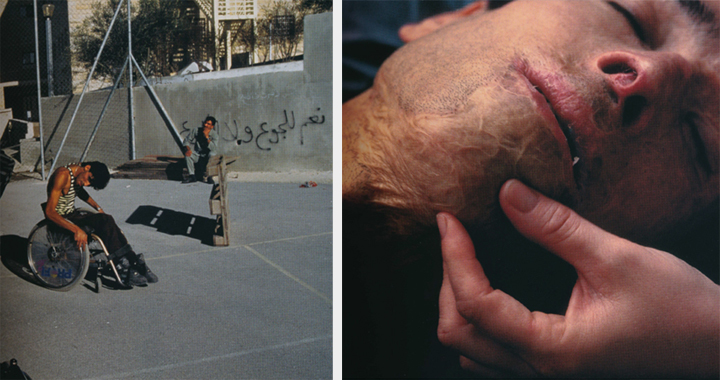 On the left, a photo of a slender, medium-skin toned adult man slumped in a wheelchair on a nearly empty concrete plaza. On the right, a medium-light skinned adult person's face being cradled by a light-skinned hand; the face is mottled and scarred.
