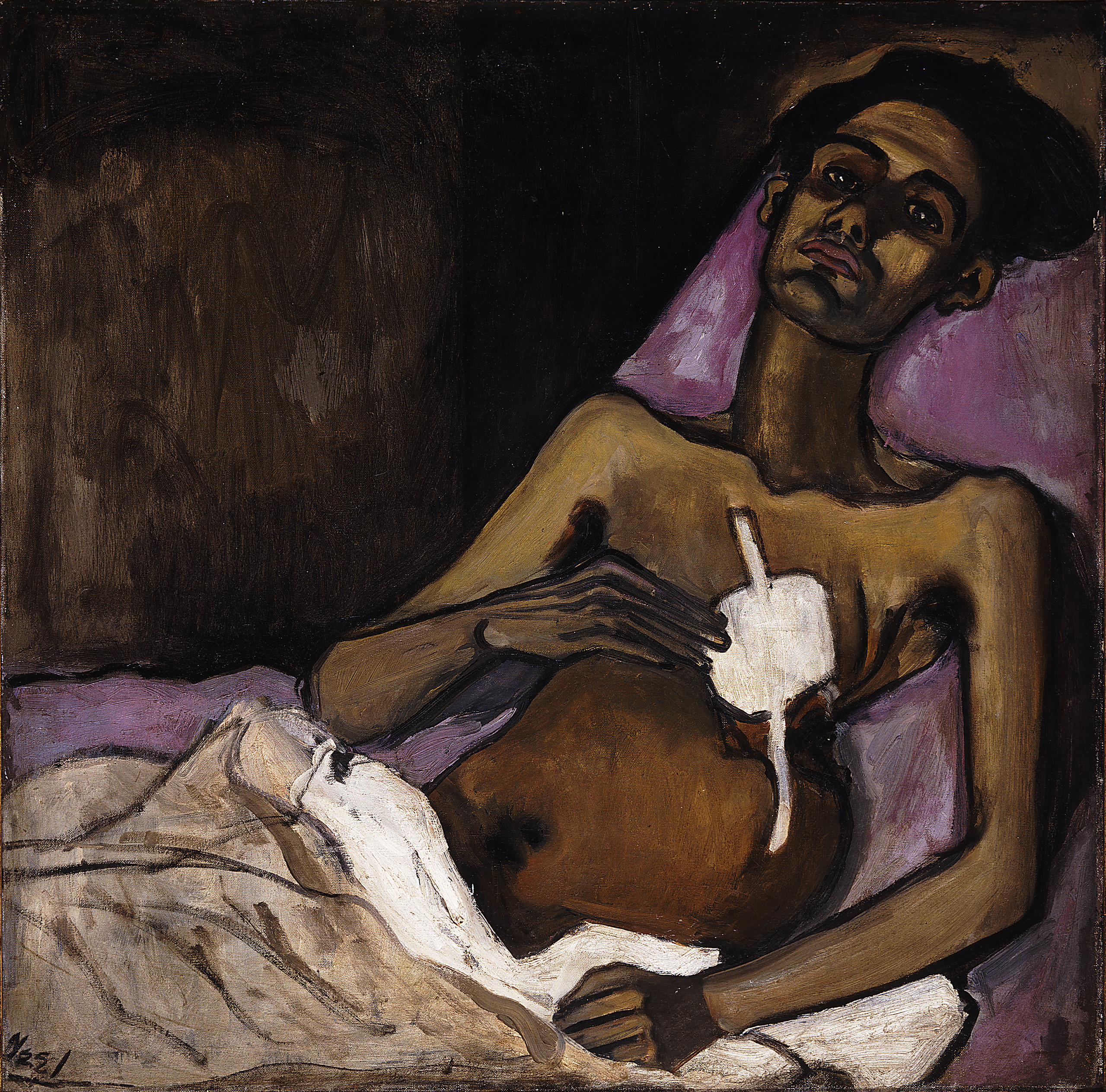 A sick man with medium skin tone lies on a bed with purple bedding and stares out with a dignified expression. The left side of his chest is misshapen and covered with a white bandage. Thick outlines define his body and highlights on his arms and face accentuate his frail frame.
