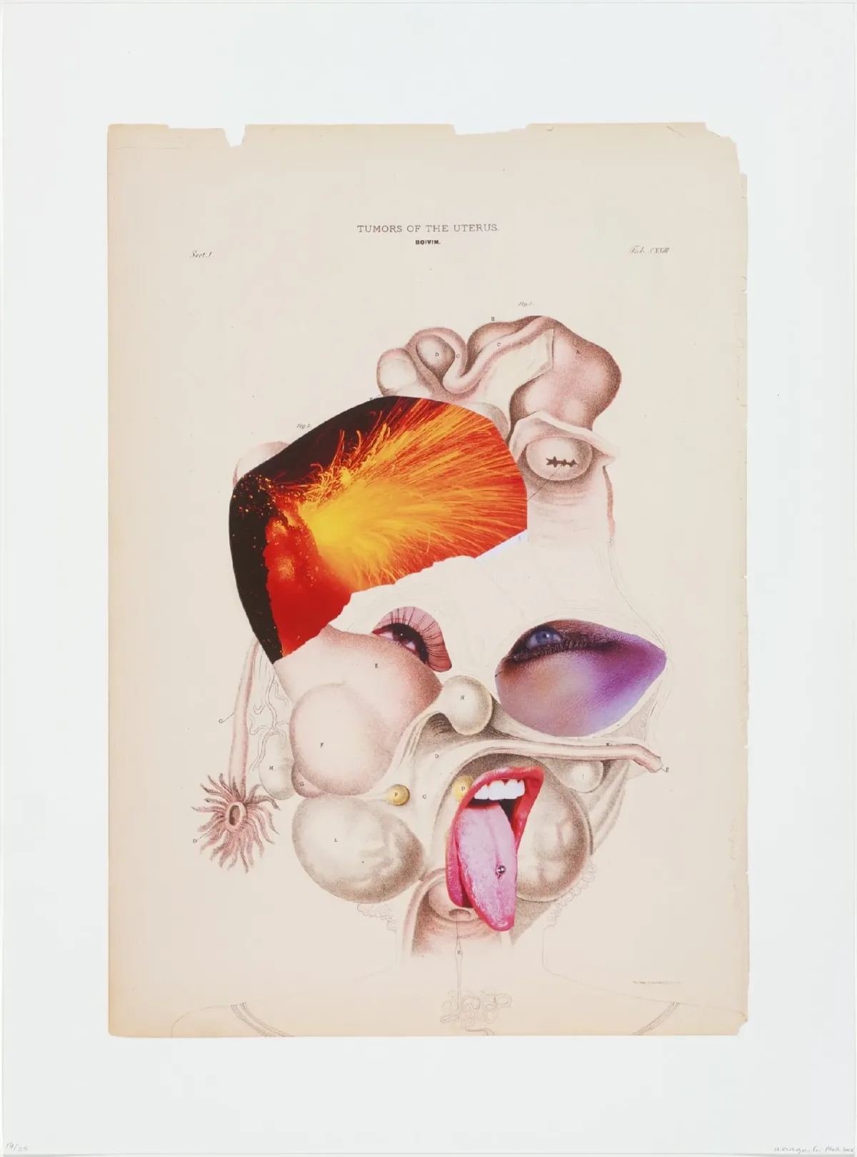 A collage shows a face that is created from various separate images showing facial features, internal organs, and ambiguous elements. Most evident are two eyes and a mouth with its tongue sticking out that are pasted atop a medical illustration.