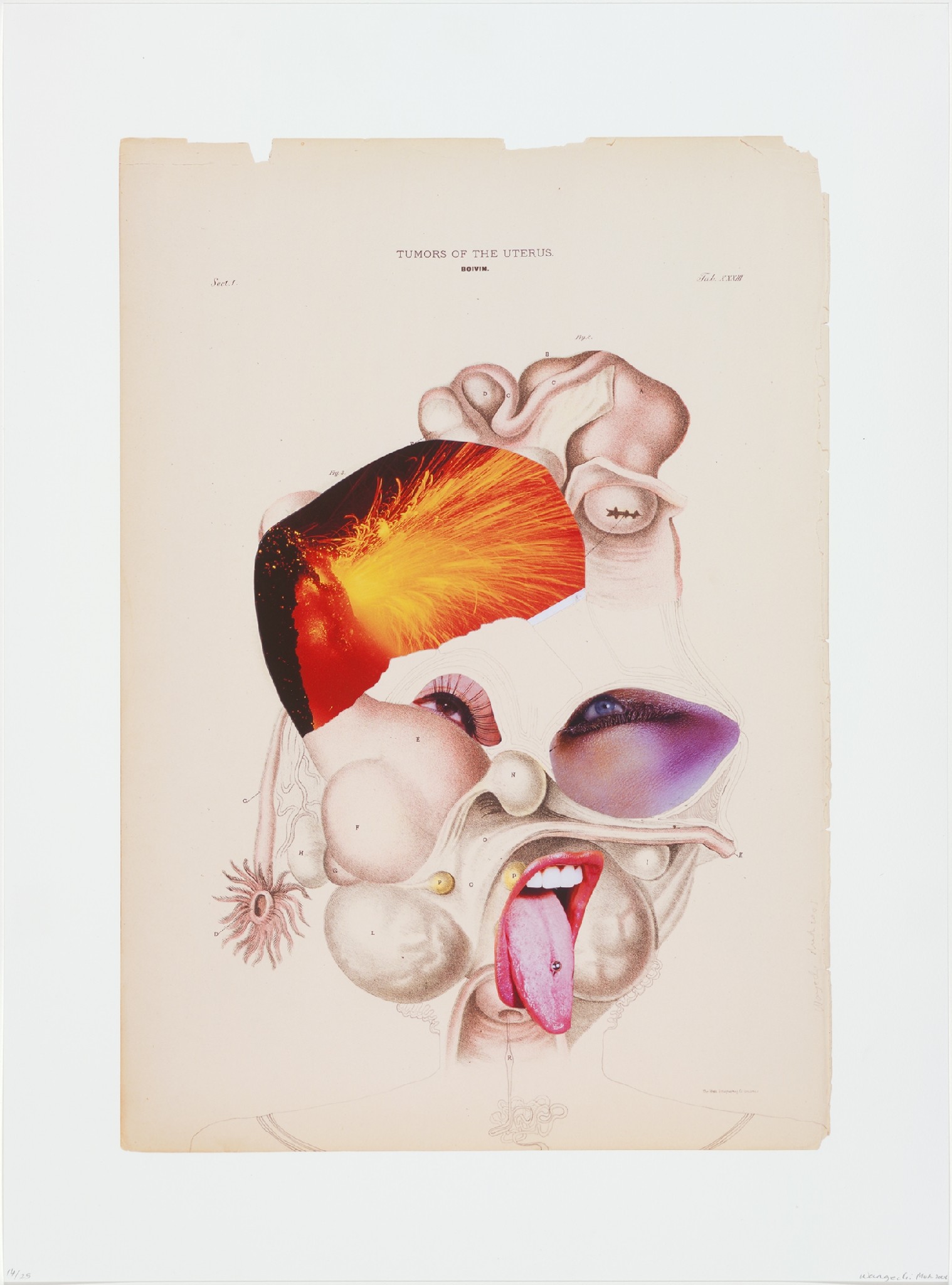 A collage shows a face that is created from various separate images showing facial features, internal organs, and ambiguous elements. Most evident are two eyes and a mouth with its tongue sticking out that are pasted atop a medical illustration.