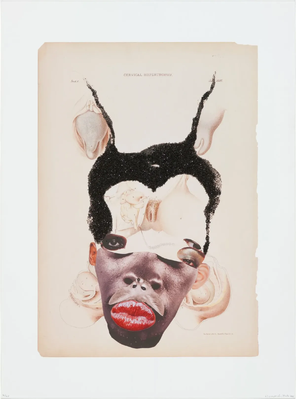 A collage shows a face that is created from various separate images showing facial features, internal organs, and ambiguous elements. Most evident is the lower half of a dark-skinned woman's face that is overlaid with bright red lips, medical illustrations, and two eyes set widely apart. Her black afro is overlaid with more medical illustrations.