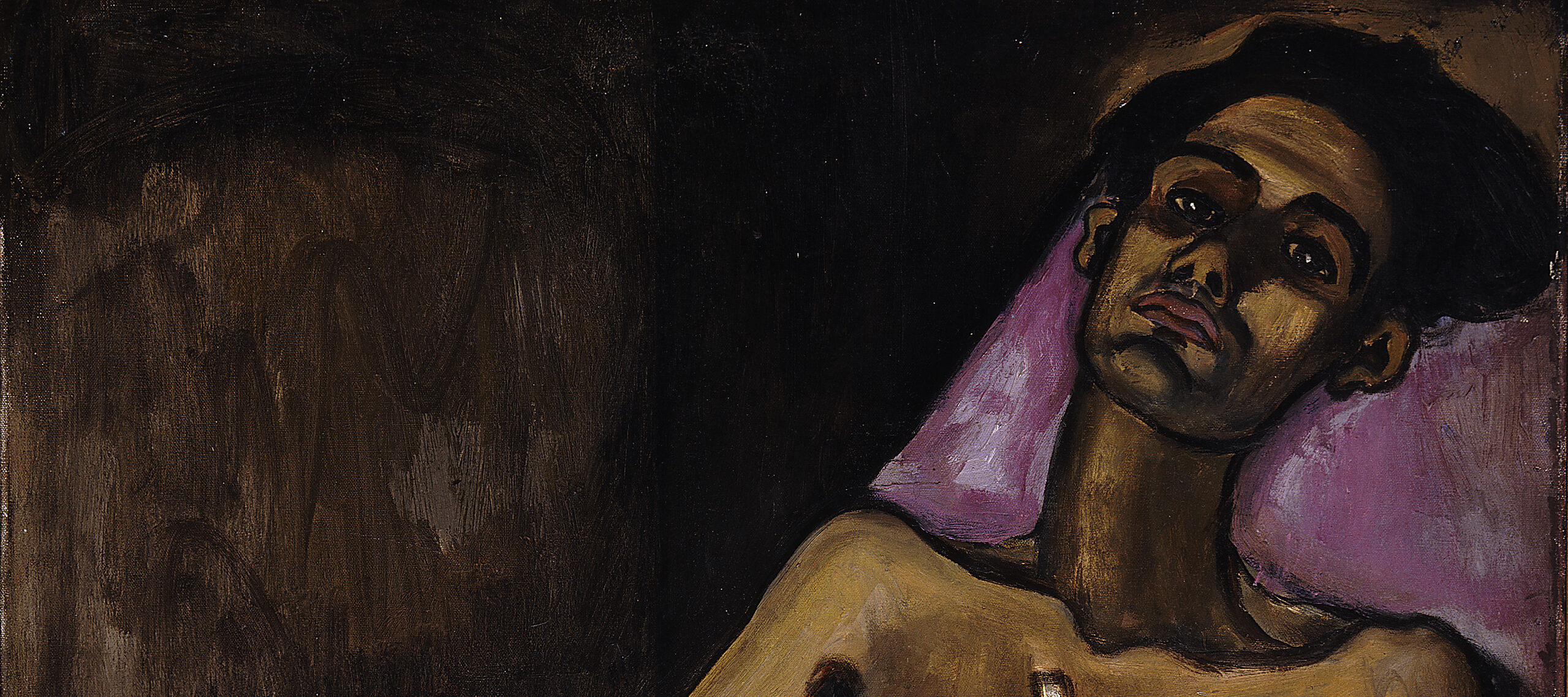 A sick man with medium skin tone lies on a bed with purple bedding and stares out with a dignified expression. The left side of his chest is misshapen and covered with a white bandage. Thick outlines define his body and highlights on his arms and face accentuate his frail frame.