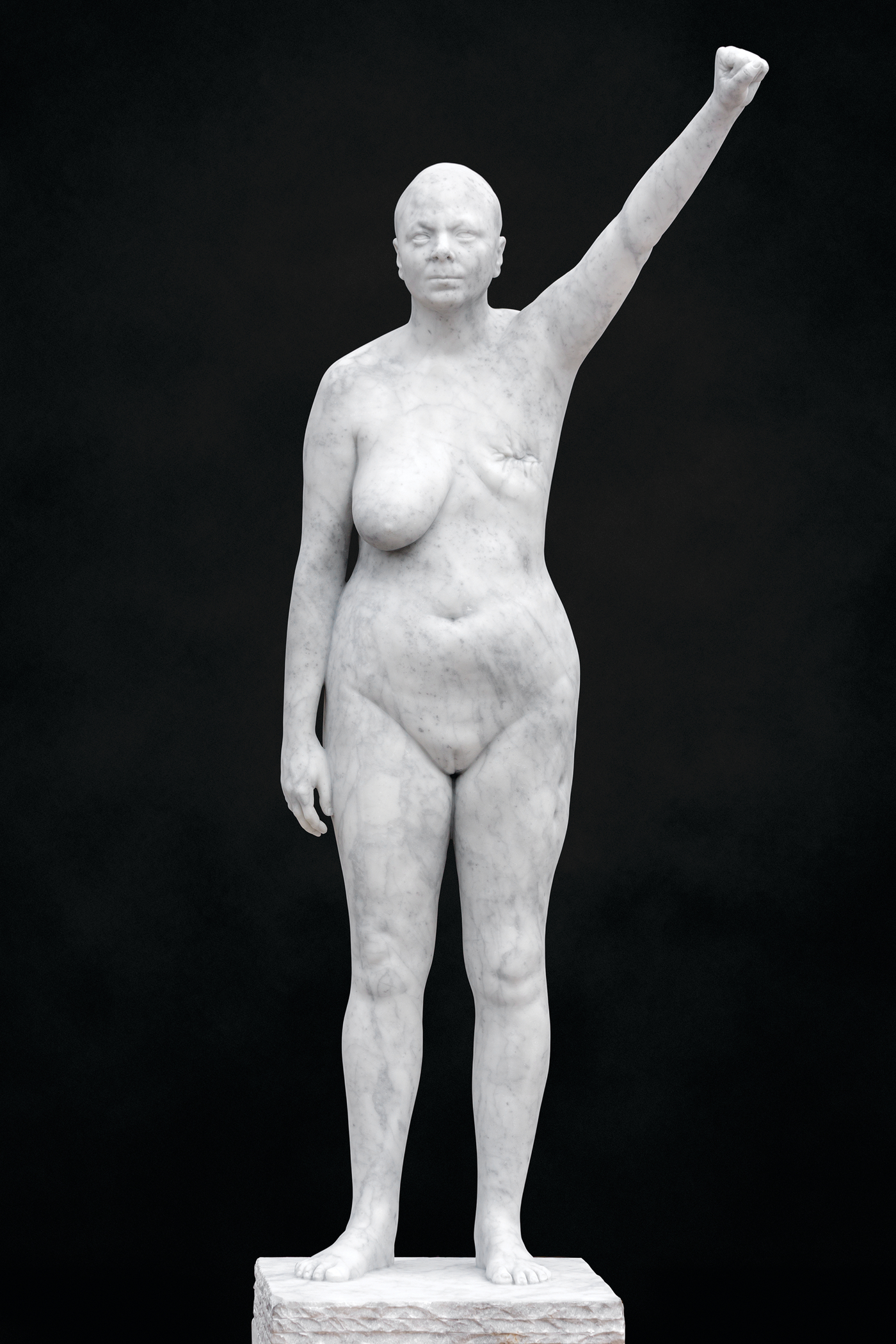 A nude life-size white marble statue of a figure stands on a platform. One fisted arm is raised above its head while the figure shows one breast surgically removed.