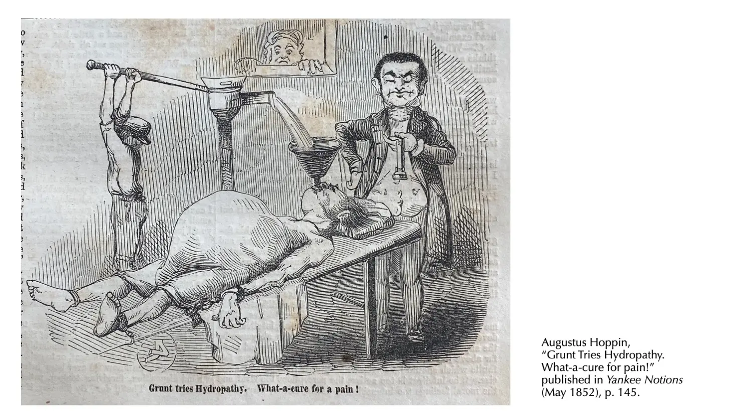 A 19th-century medial illustration shows a male doctor inflating his patient like a water balloon.